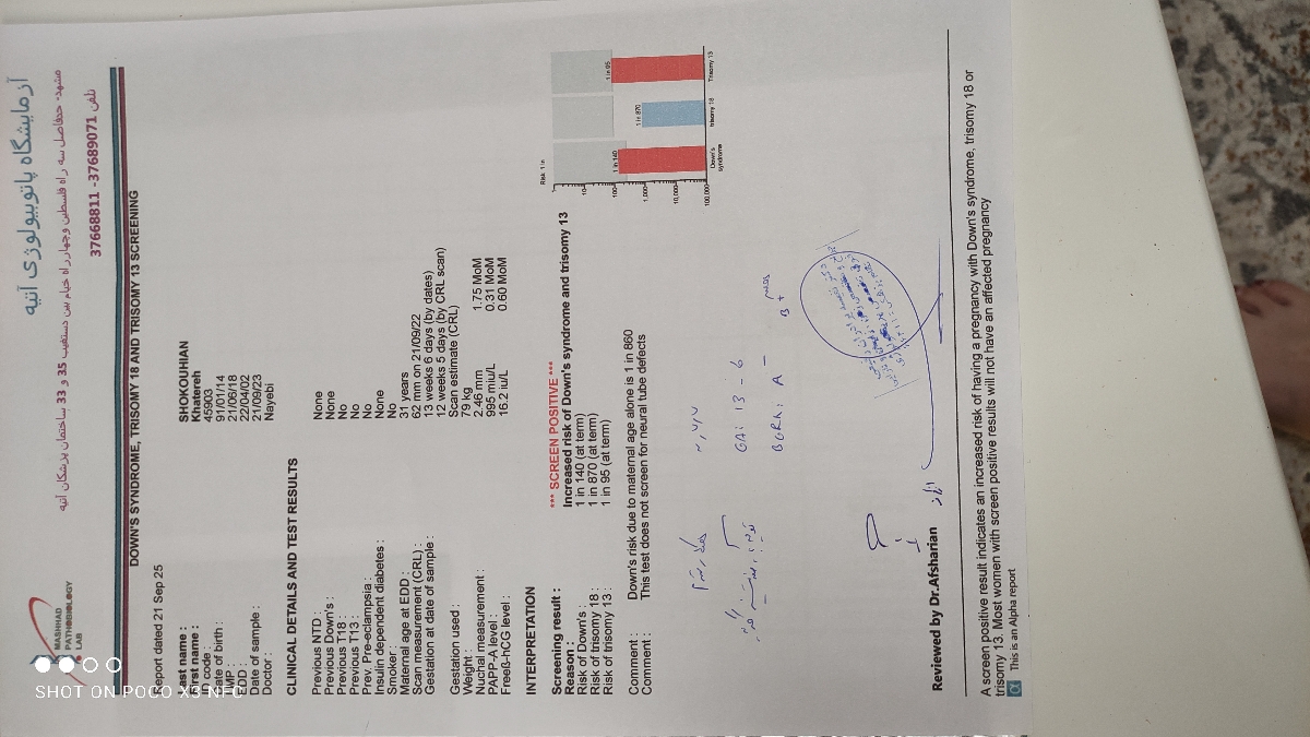 کسی بوده ان تی اولش بالا باشه و ریسک سندروم و تریزمیشم در آزمایش بالا باشه