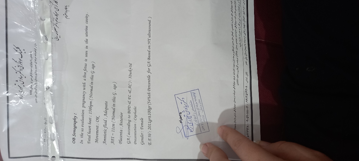 سونو وزن نی نی نرماله؟ سونو وزن نی نی نرماله؟