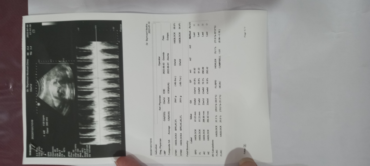 سونو وزن نی نی نرماله؟ سونو وزن نی نی نرماله؟
