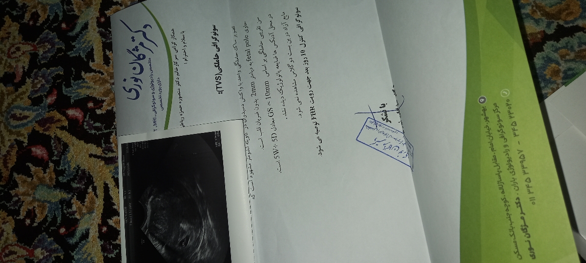 تفسیر سونوی ۶ هفته