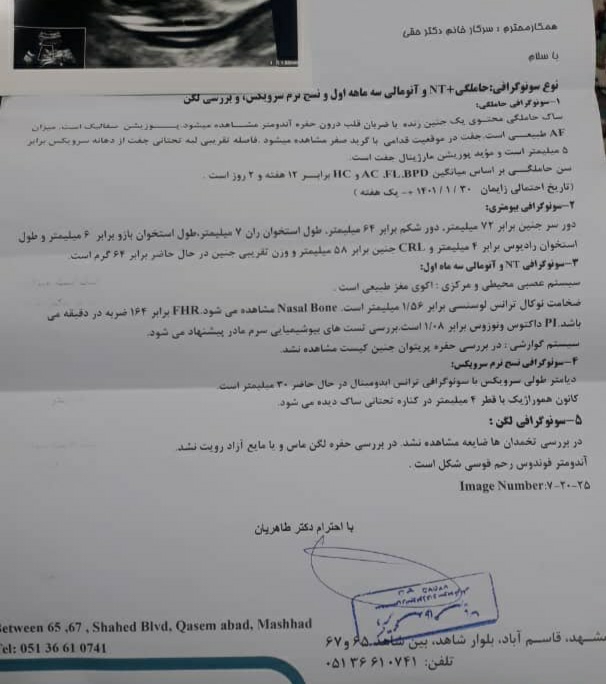 تفسیر سونو ان تی