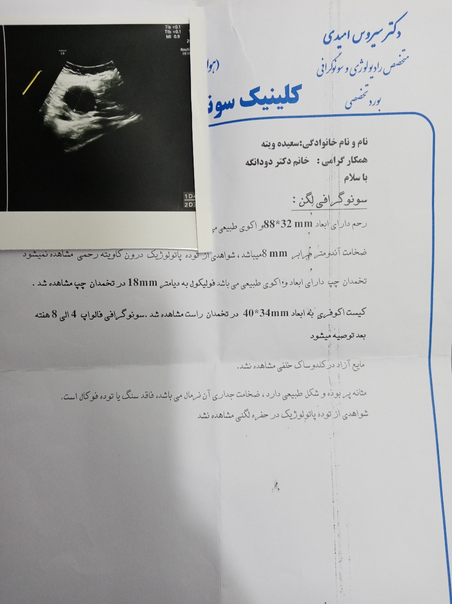سنوگرافی رحم سایز فولیکول سنوگرافی رحم سایز فولیکول