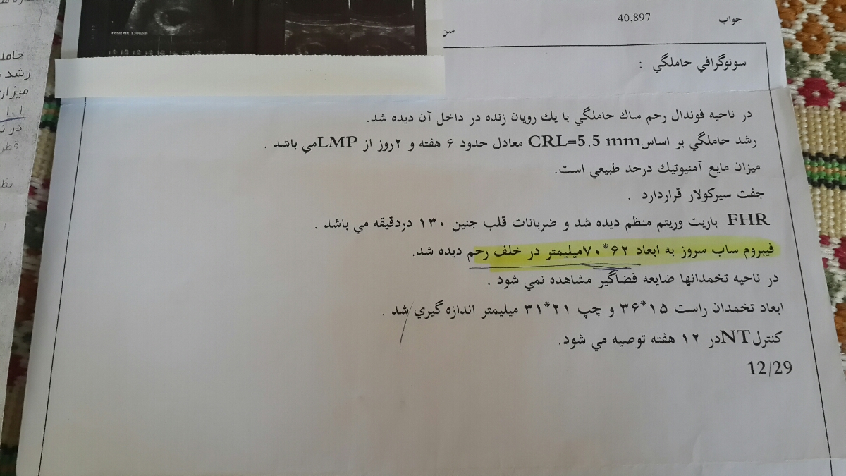فیبروم در هفته 18 بارداری فیبروم در هفته 18 بارداری