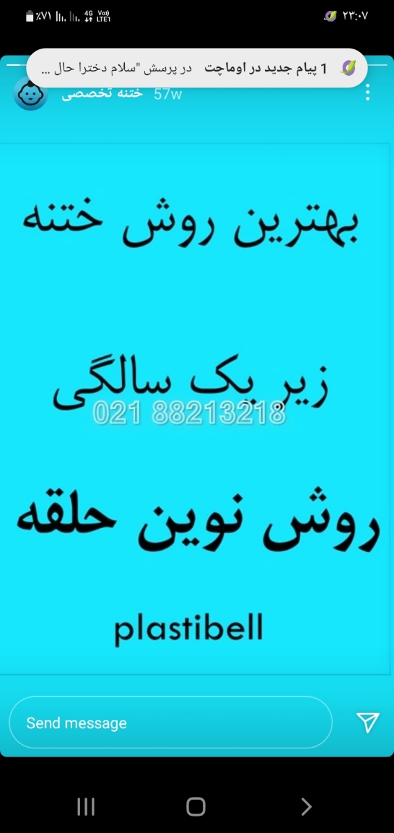 ختنه در ۶ ماهگی حلقه یا سنتی