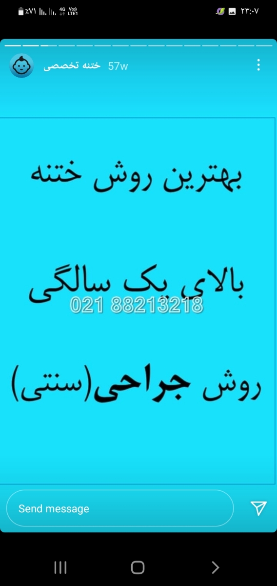 ختنه در ۶ ماهگی حلقه یا سنتی