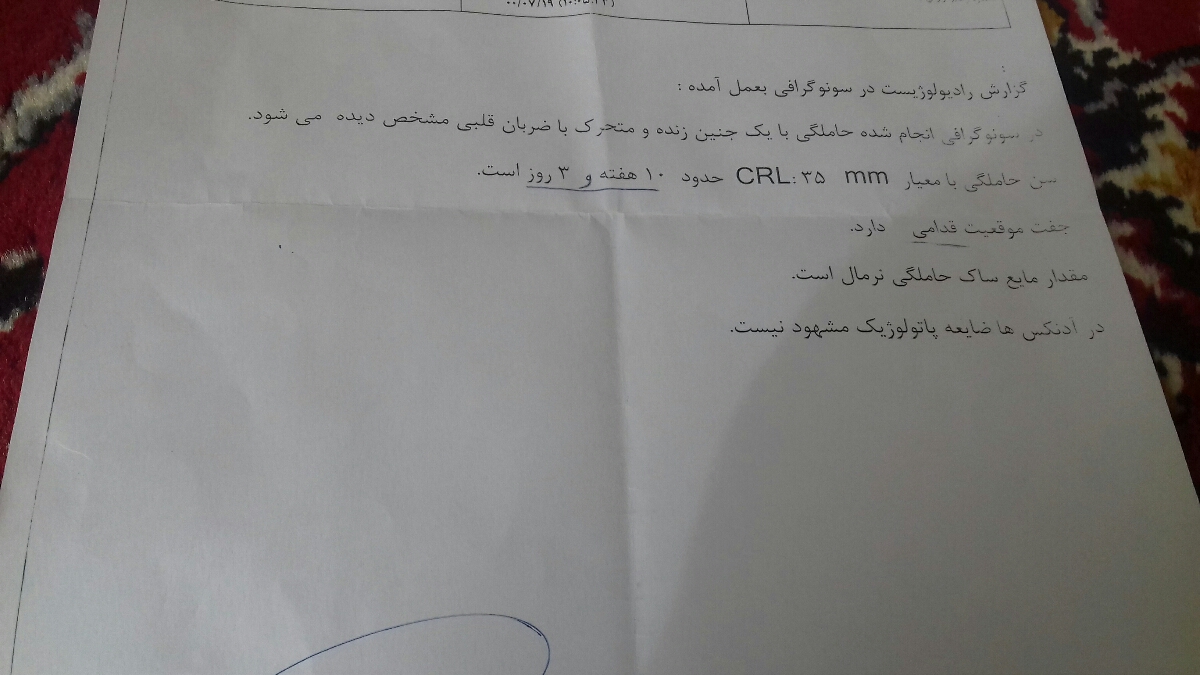 قرارگیری جفت در بارداری قرارگیری جفت در بارداری