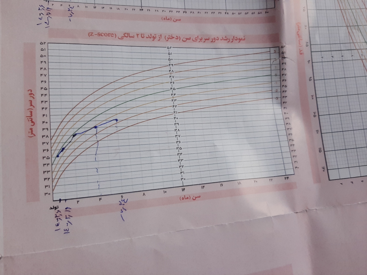 اندازه دور سر نوازد دختر