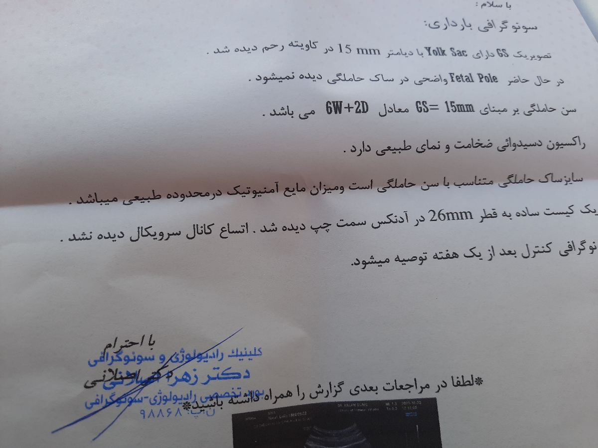 لکه بینی قهوه ای رنگ بعد از آرزمایش لکه بینی قهوه ای رنگ بعد از آرزمایش