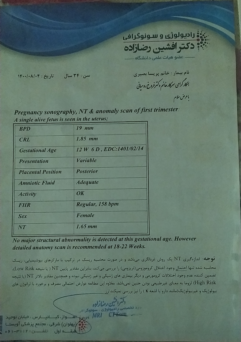 سونو nt خواستم بدونم خوبه