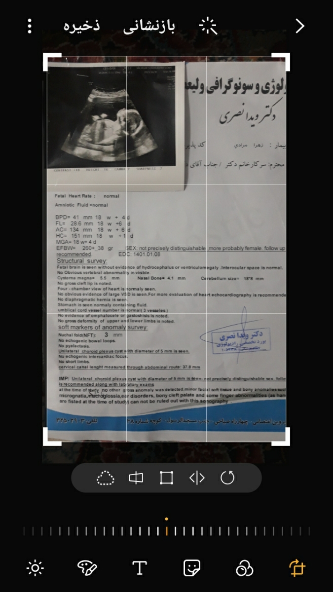 سلامخانم دکتر میشه سونو انومالی منو ببینید و درمورد جنسیت توضیح بدید سلامخانم دکتر میشه سونو انومالی منو ببینید و درمورد جنسیت توضیح بدید