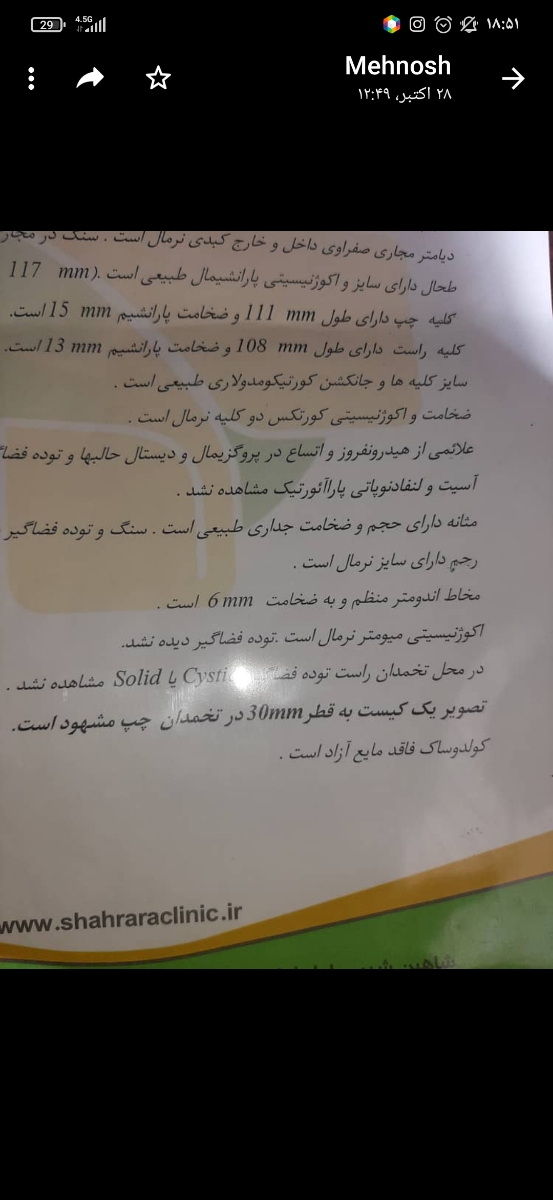 کیست تخمدان و درمان آن
