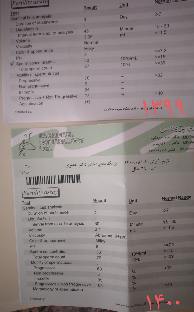 جواب آزمایش اسپرم همسر