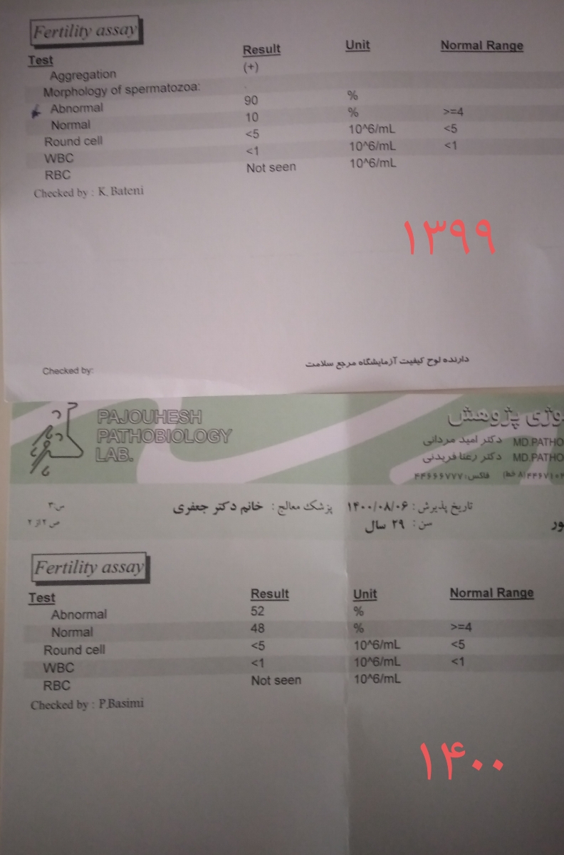 جواب آزمایش اسپرم همسر