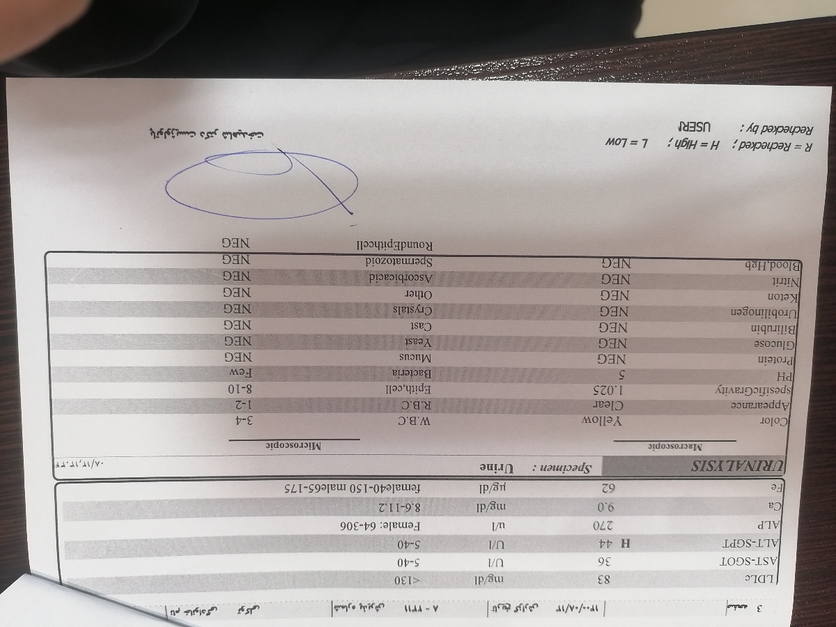 تفسیر چکاب آزمایش