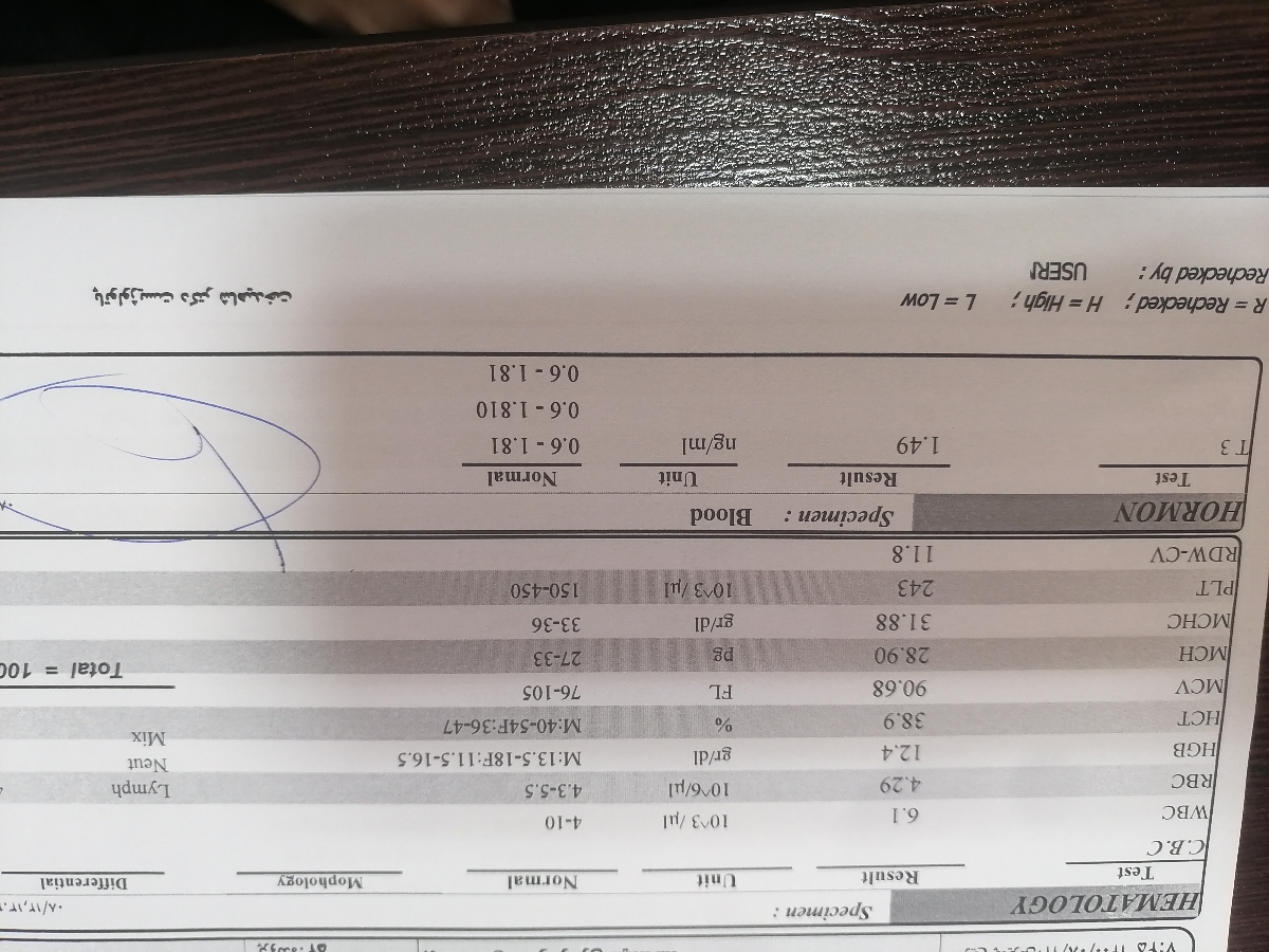تفسیر چکاب آزمایش