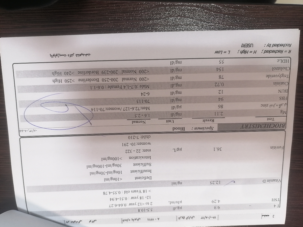 تفسیر چکاب آزمایش