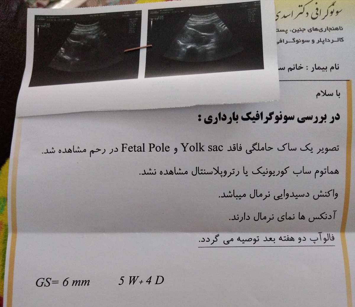 خانم های باردار خرداد و تیر 1401بیاین 😍