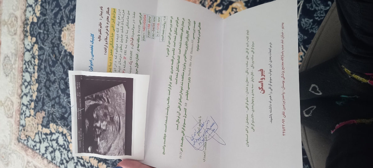 تفسیر سونو ان تی