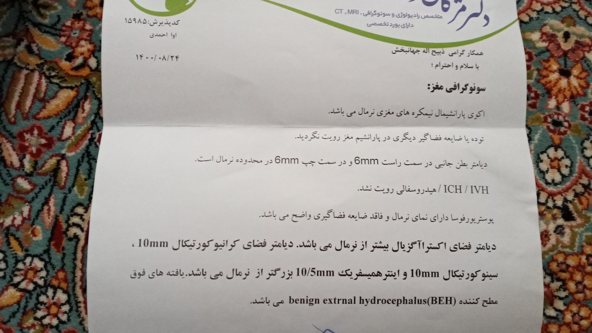 اندازه مناسب دور سر نوزاد اندازه مناسب دور سر نوزاد