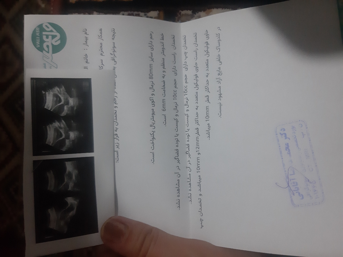 تفسیرجواب سونو و فولیکول تفسیرجواب سونو و فولیکول