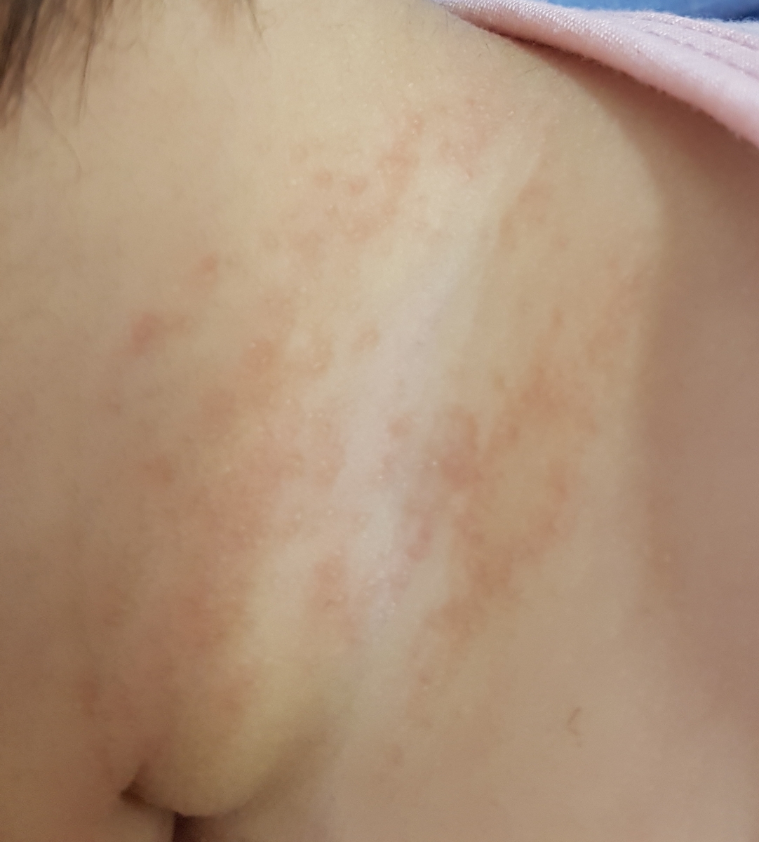 جوش ریز قرمز رنگ😪😪😪😪😪😪😪😢😢😢😢 جوش ریز قرمز رنگ😪😪😪😪😪😪😪😢😢😢😢