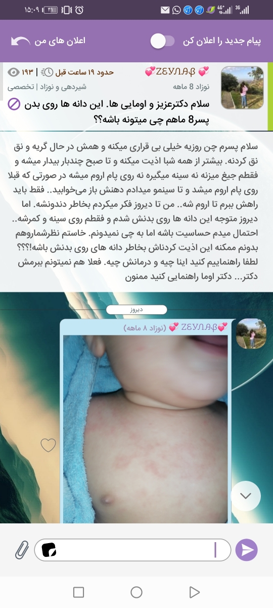 سلام دکترعزیز و اومایی ها. این دانه ها روی بدن پسر8 ماهم چی میتونه باشه؟؟ سلام دکترعزیز و اومایی ها. این دانه ها روی بدن پسر8 ماهم چی میتونه باشه؟؟
