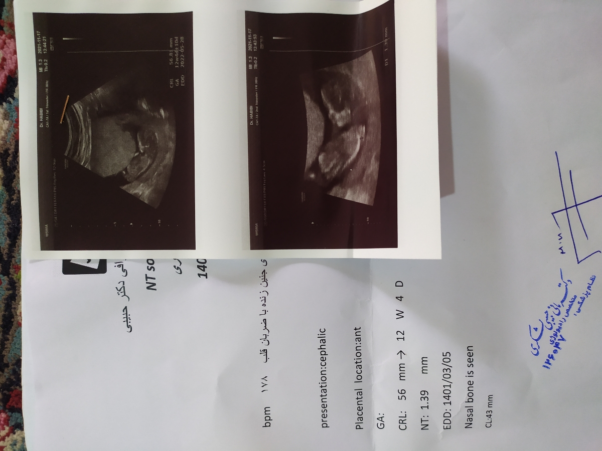 تفسیر آزمایش اولیه غربالگری