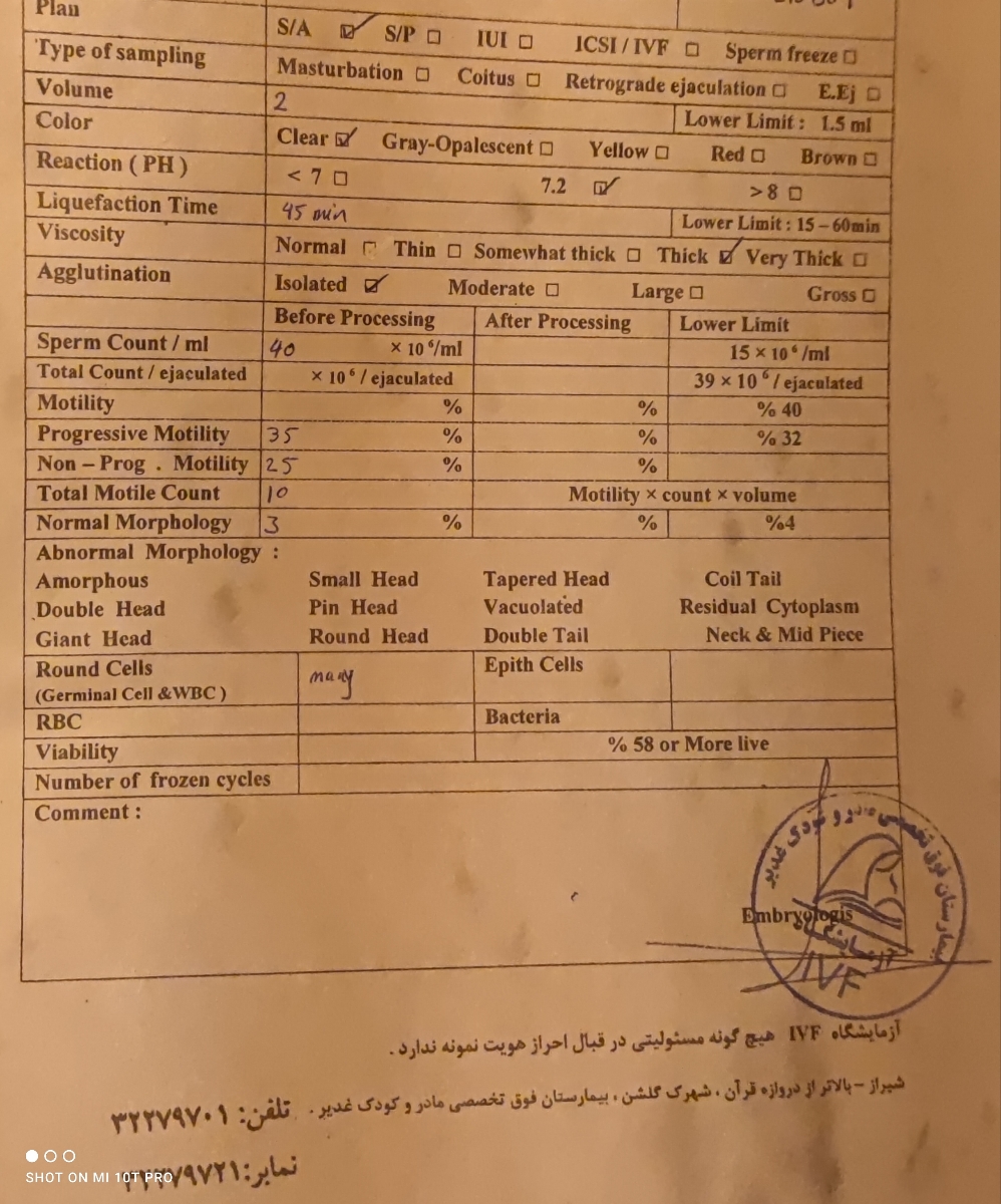 جواب آزمایش اسپرم همسرم رو تفسیر می کنید؟