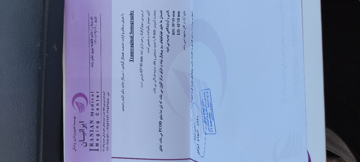 فیکول ریز وتنبلی تخمدان فیکول ریز وتنبلی تخمدان
