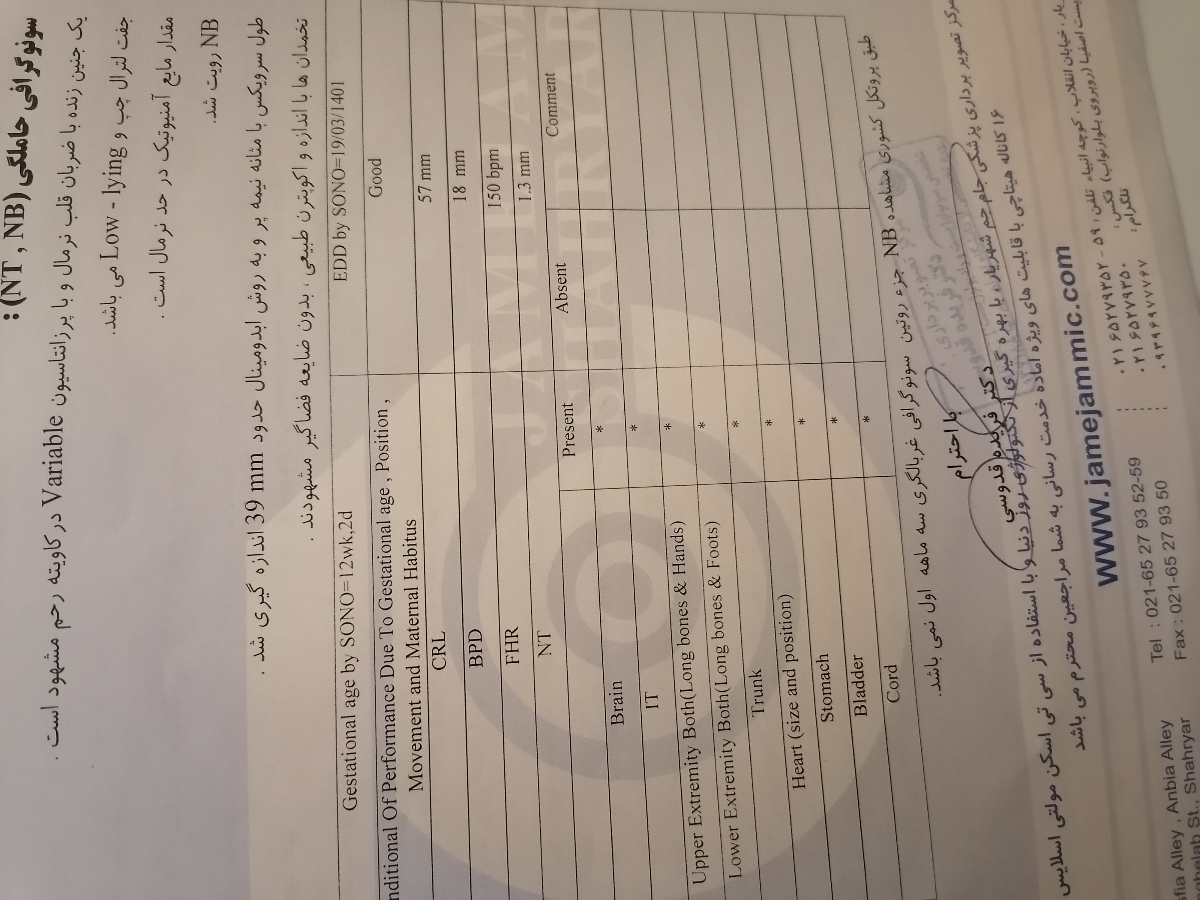 تشخیص جنسیت از سونو ان تی