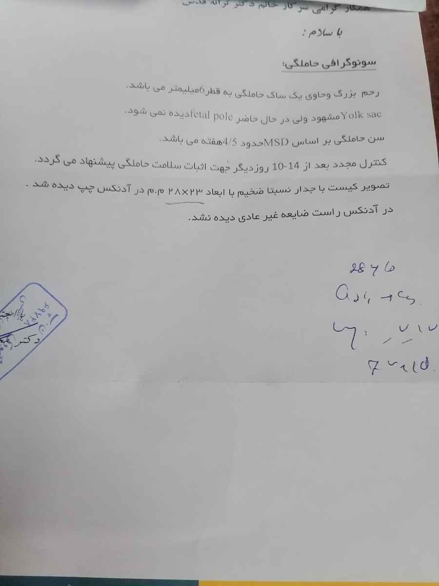 ساک بارداری وکیست ساک بارداری وکیست