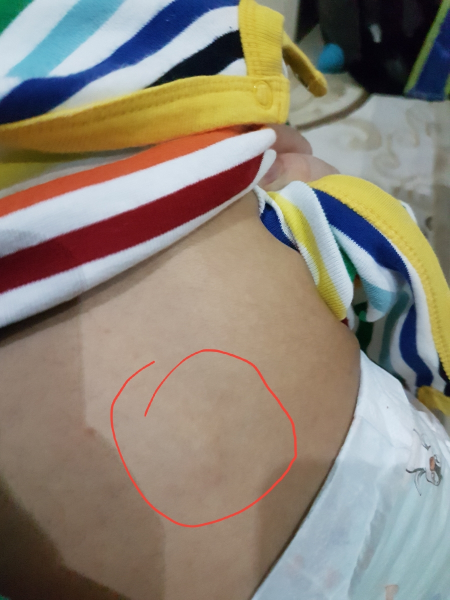 ستون فقرات در کودکان نوپا ستون فقرات در کودکان نوپا