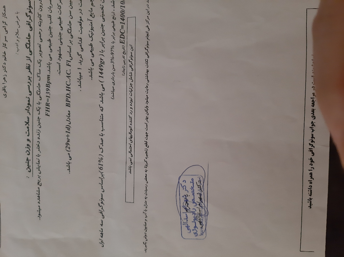 سونوی سی و هفت هفتگی