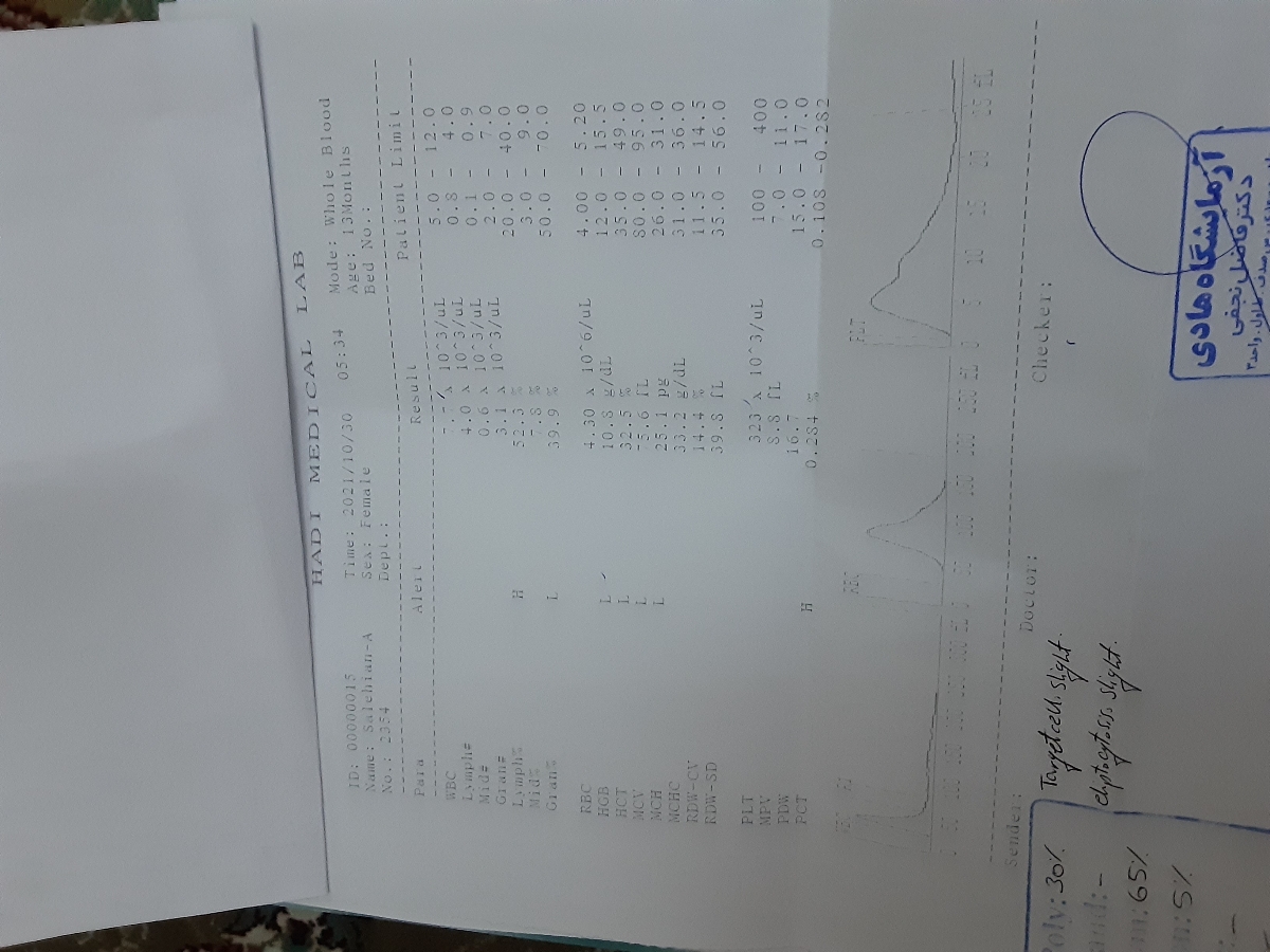 کم خونی کودک ۱۳ ماهه