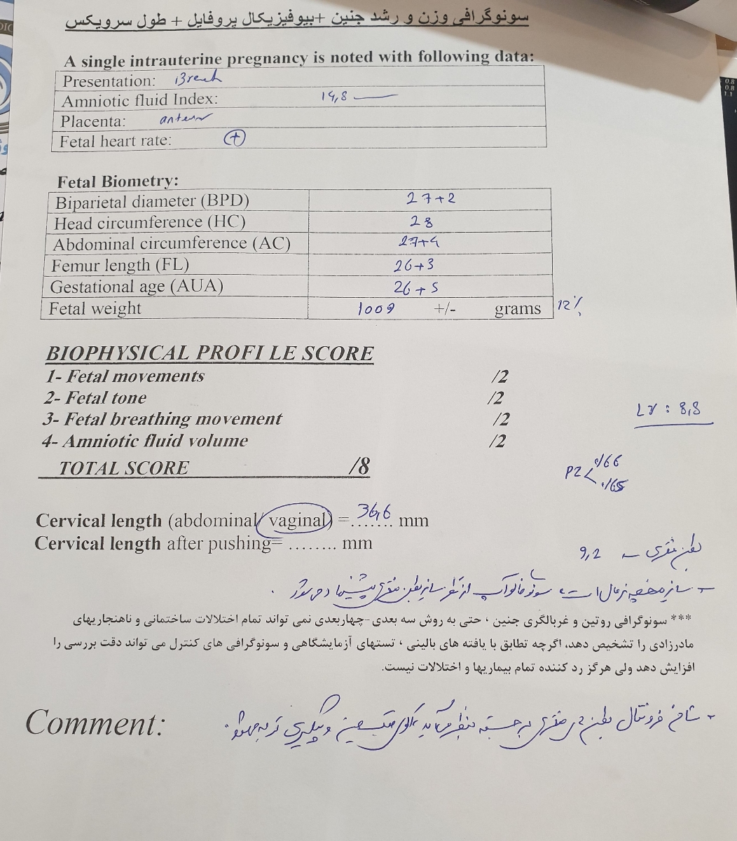 برجستگی بطنهای مغز جنین