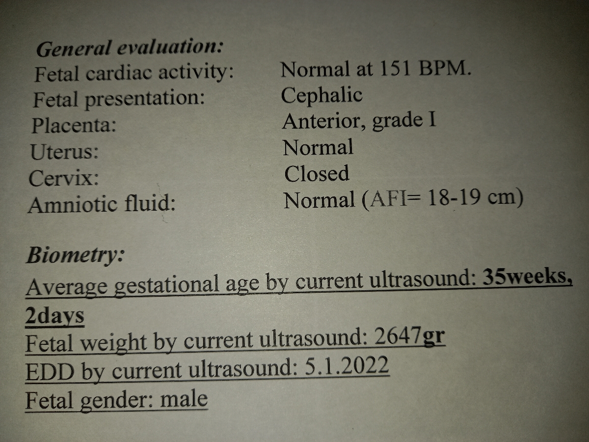 سلام مامانا.میترام.میشه بیاید سونورو ببینید
