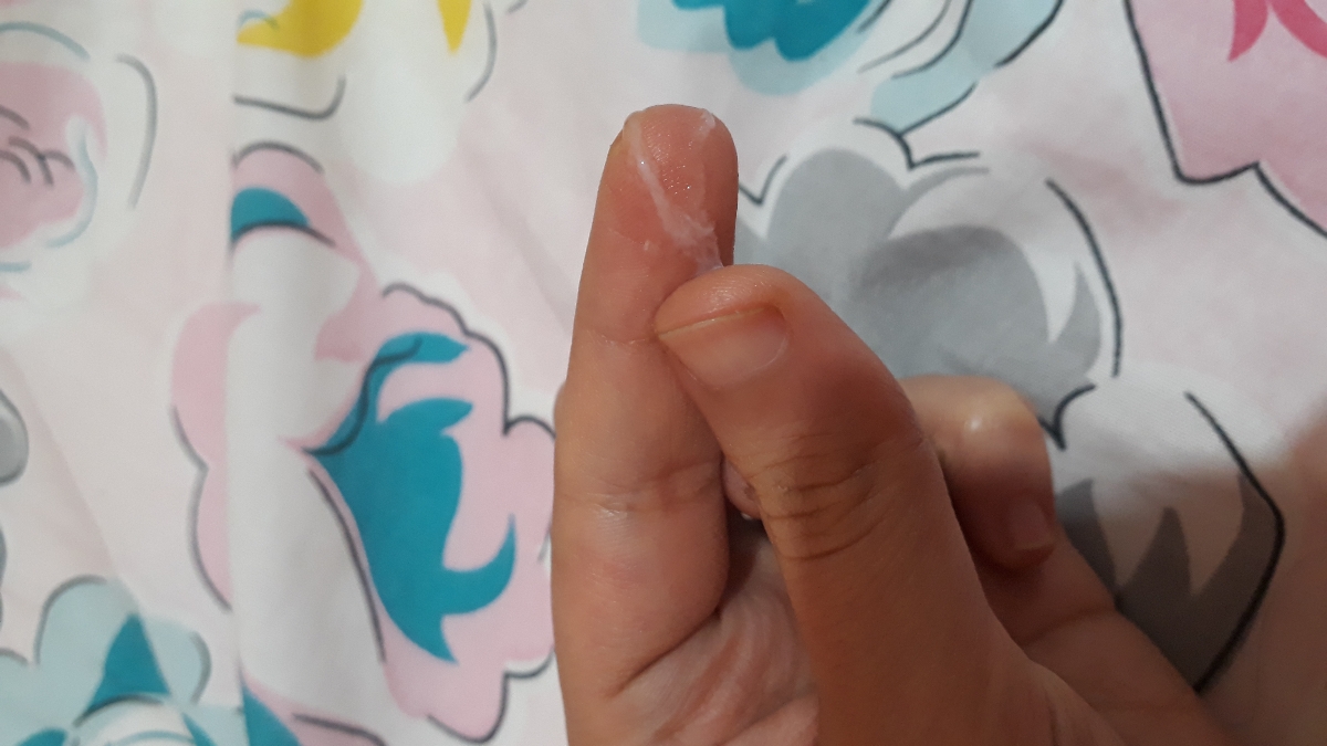 📢💦دکتر و دوستان متخصص سرررریع جواب بدید +عکس