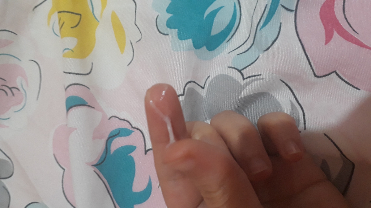 📢💦دکتر و دوستان متخصص سرررریع جواب بدید +عکس