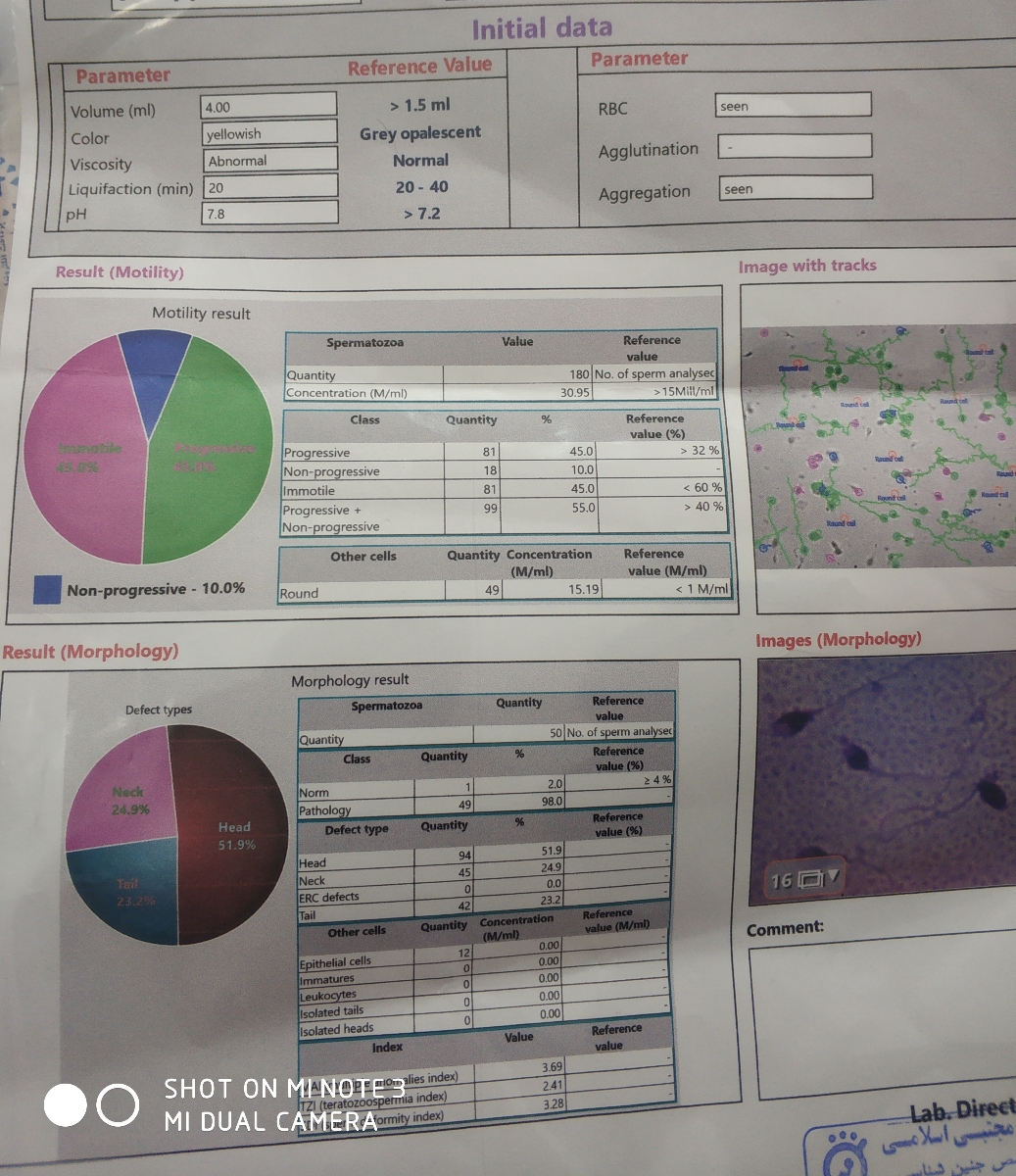 تفسیر ازمایش اسپرم همسرم