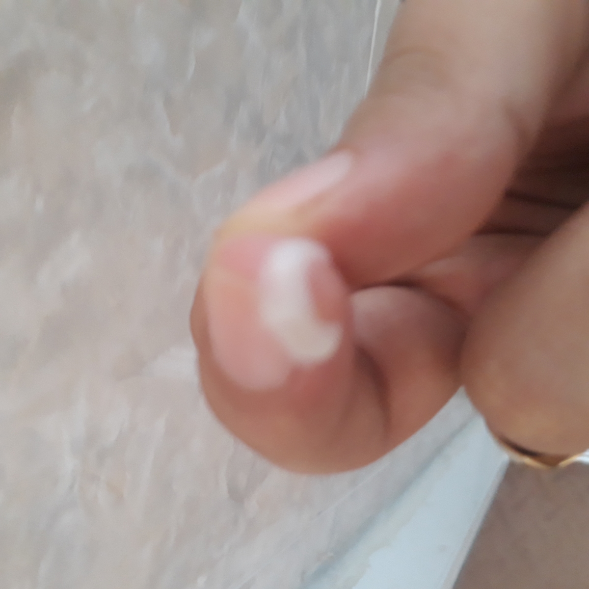 این ترشح ازچی میتونه باشه؟ این ترشح ازچی میتونه باشه؟