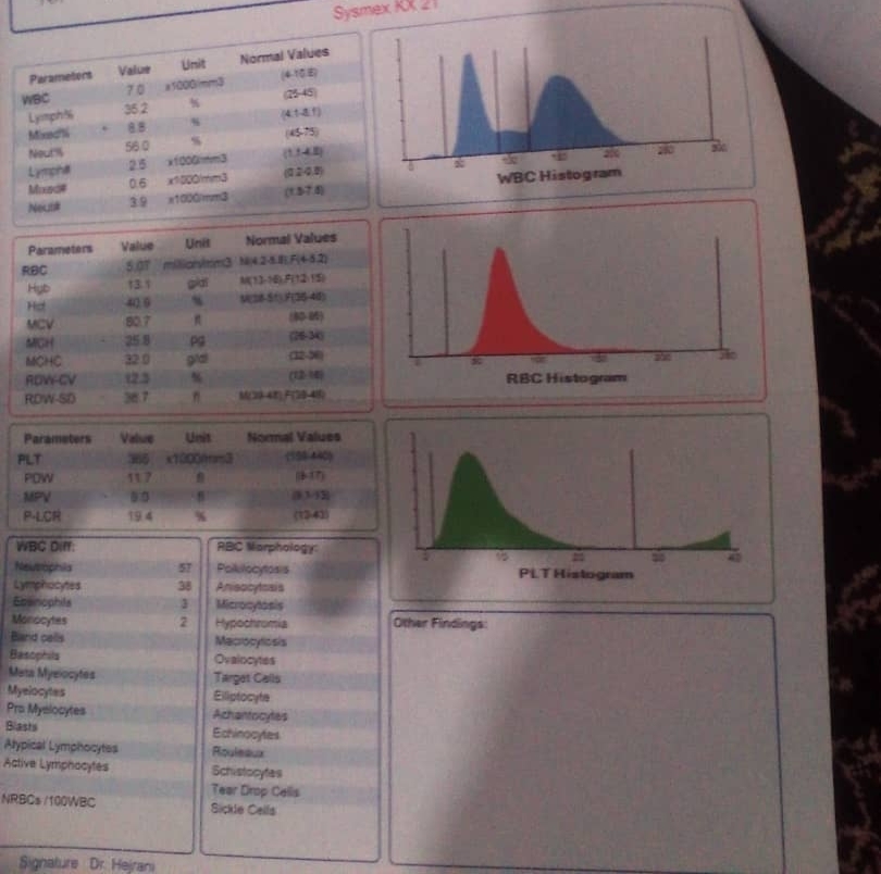 لطفا تفسیر آزمایش ممنونم