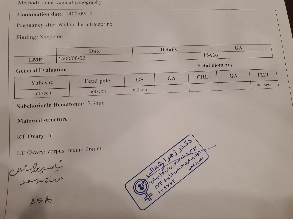 هماتوم کوچک در بارداری