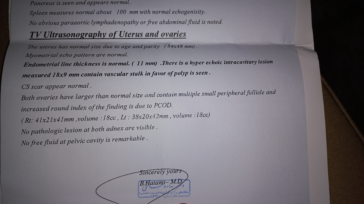 سونوگرافی و پولیپ رحم