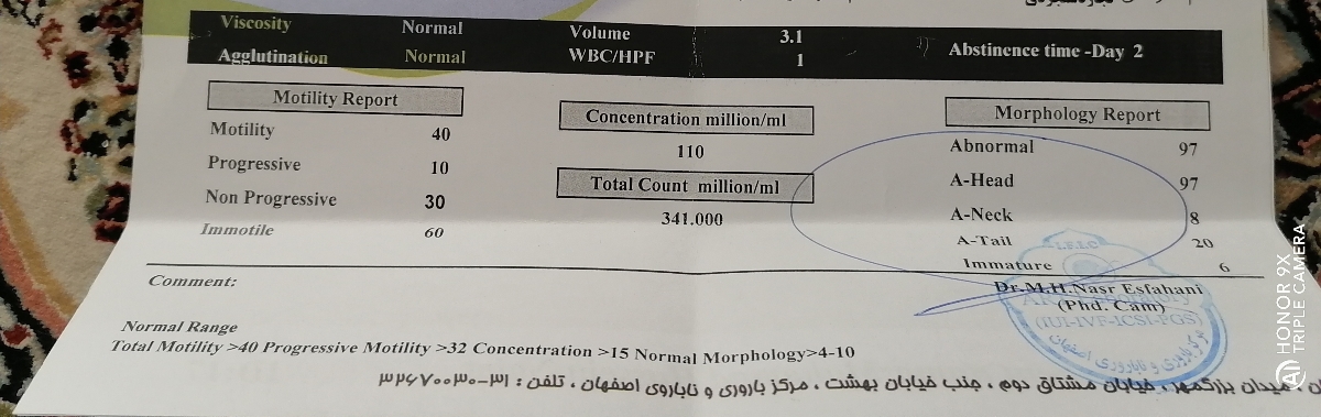 آزمایش اسپرم همسرم را نگاه می‌کنید؟