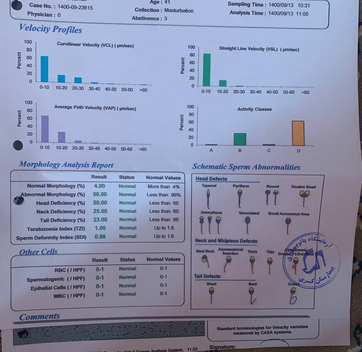 تفسیر جواب آزمایش اسپرم