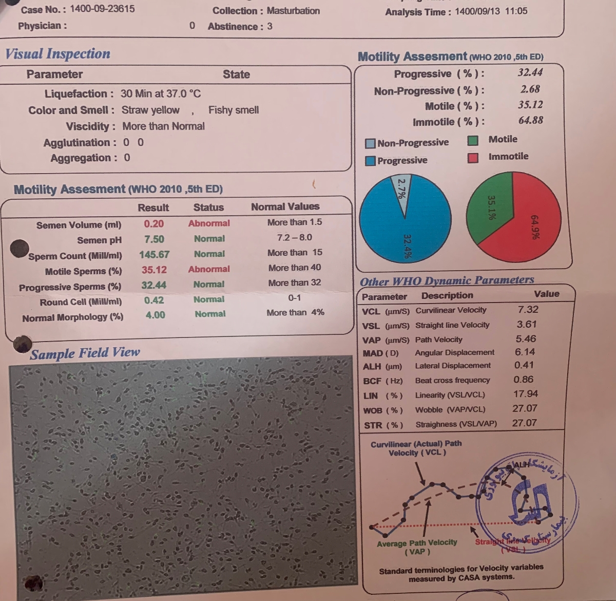تفسیر جواب آزمایش اسپرم