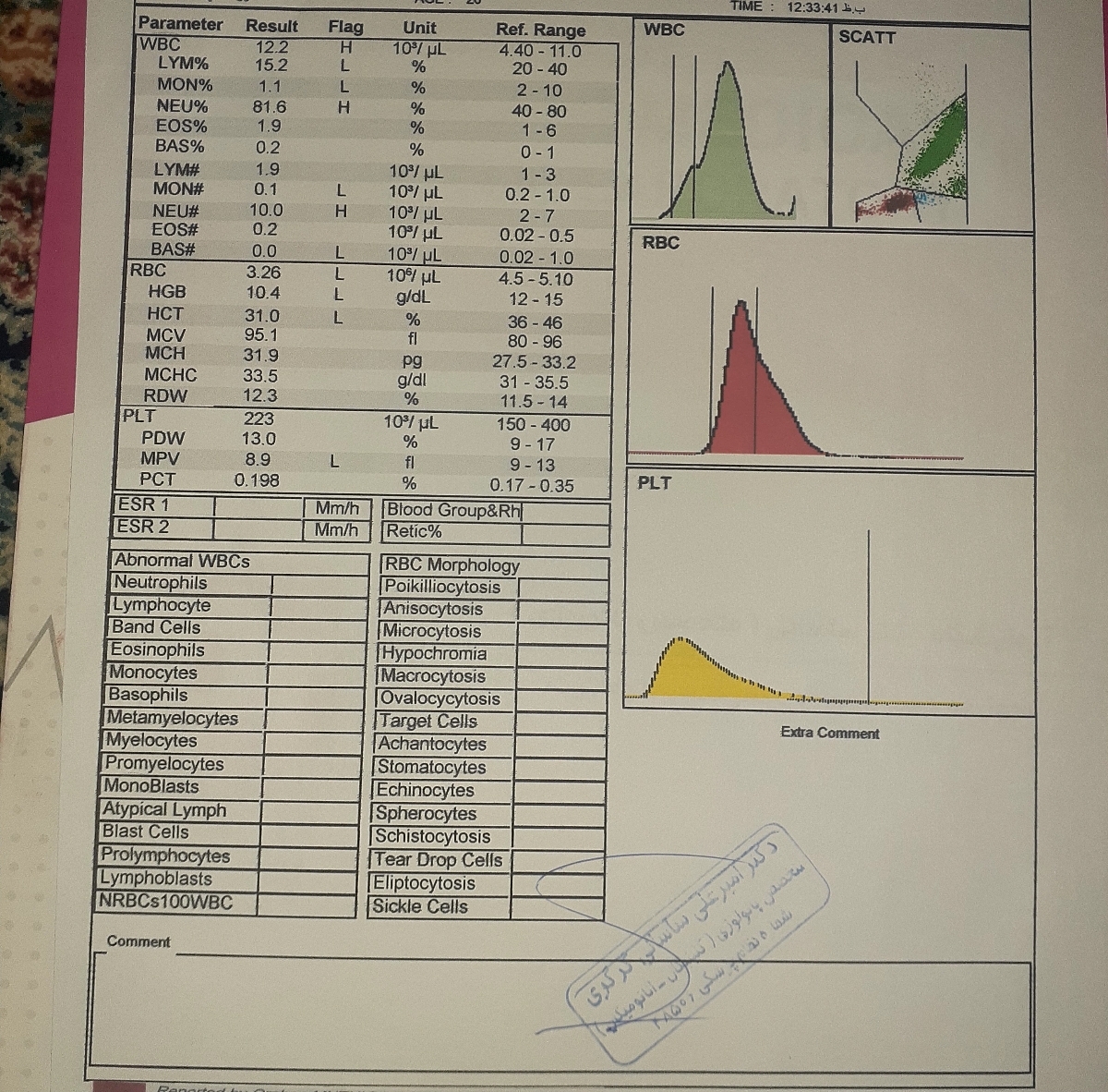 تفسیر آزمایش تست تحمل گلوکز تفسیر آزمایش تست تحمل گلوکز