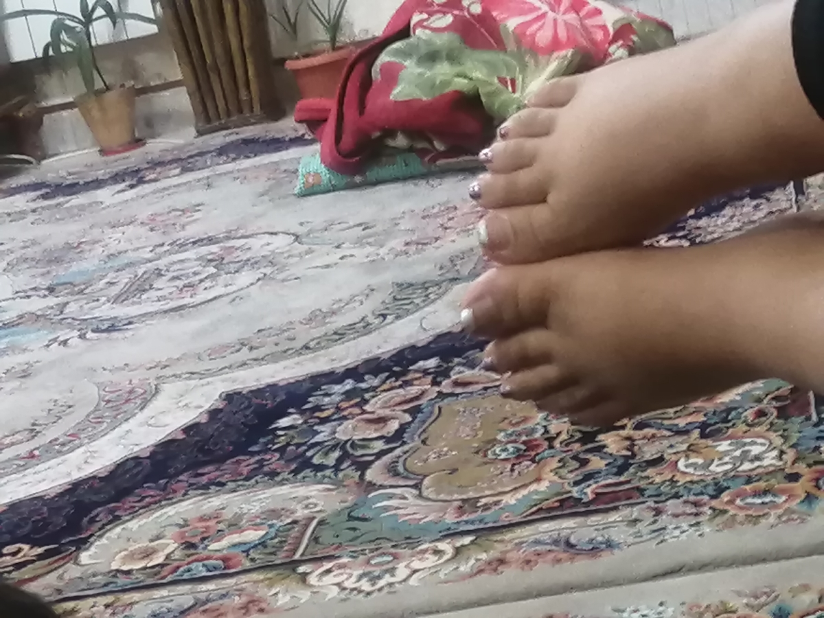 دوروز زایمان کردم ورم شدید پاهام و دوروز زایمان کردم ورم شدید پاهام و