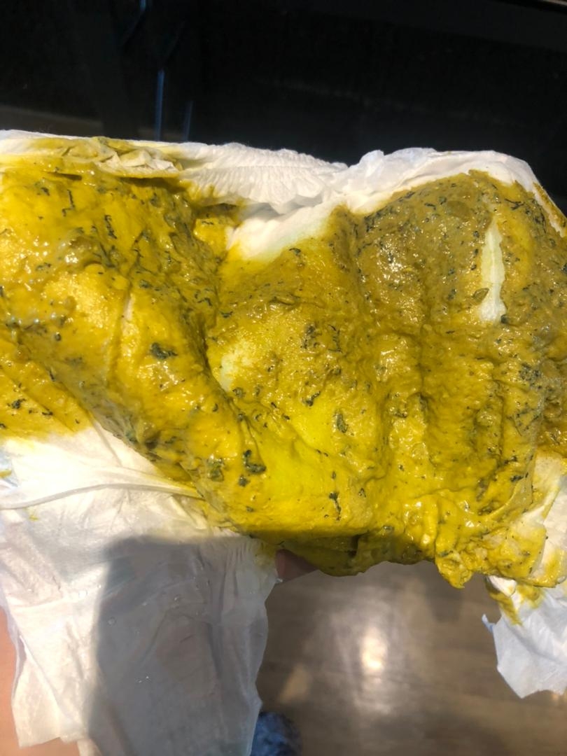 سلام عکس مدفوع نوزاد ممکن ببینید چرا اینجوری؟ شرمنده سلام عکس مدفوع نوزاد ممکن ببینید چرا اینجوری؟ شرمنده