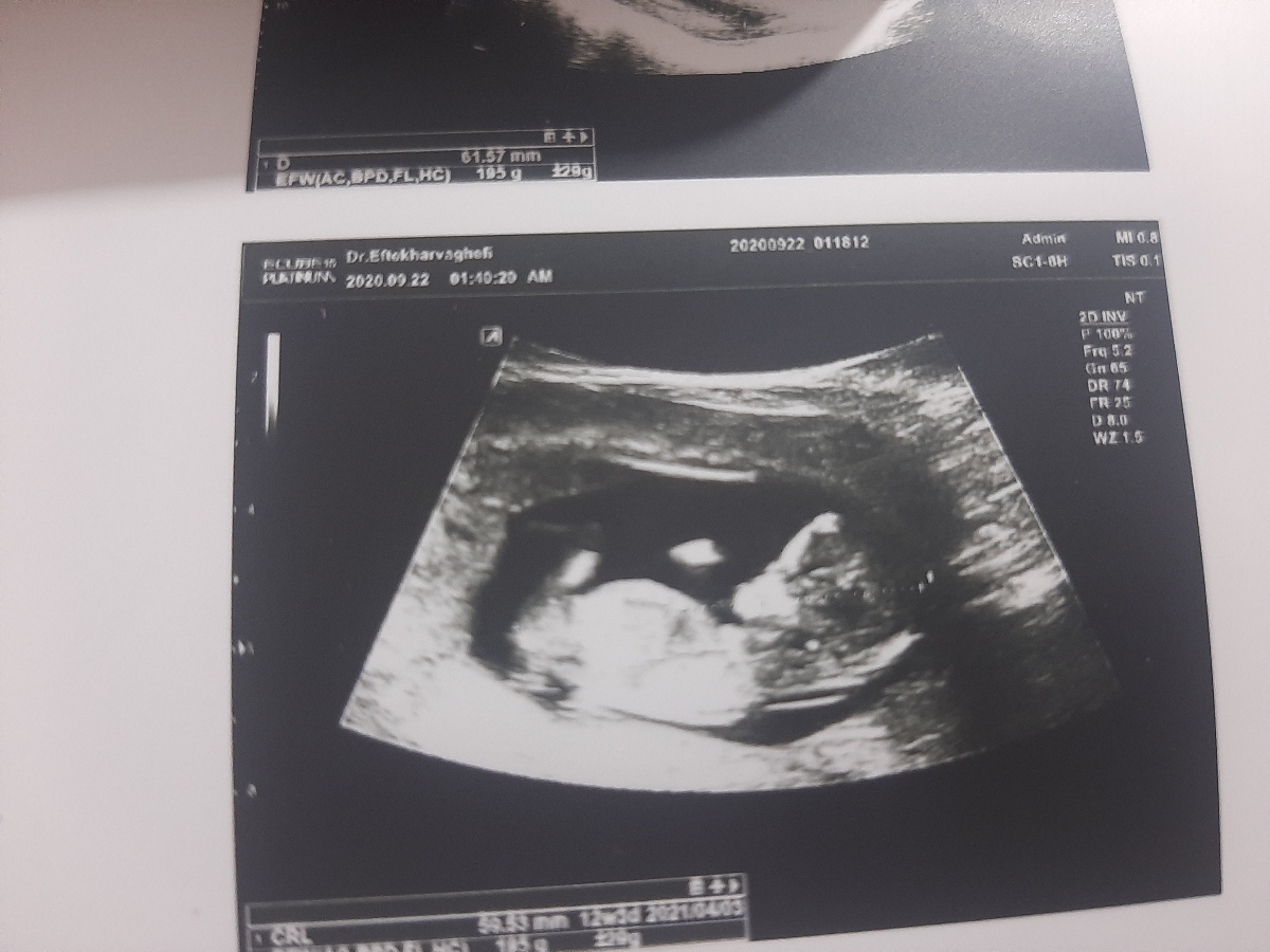 متخصصین تعیین جنسیت بیایین